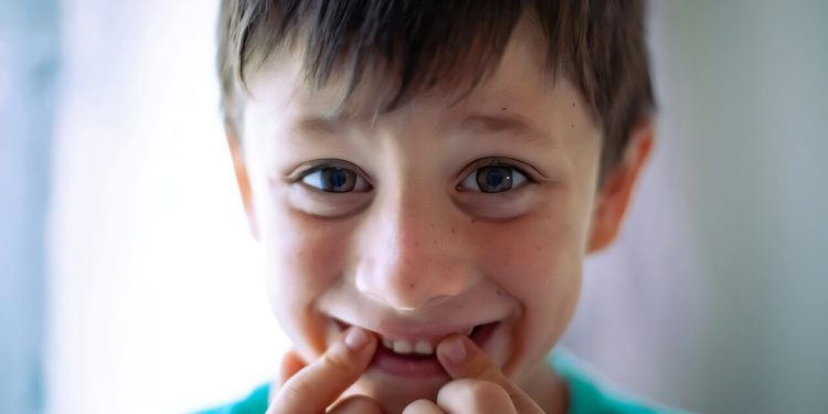 Denti dei bambini, l’infiammazione non spiega la MIH