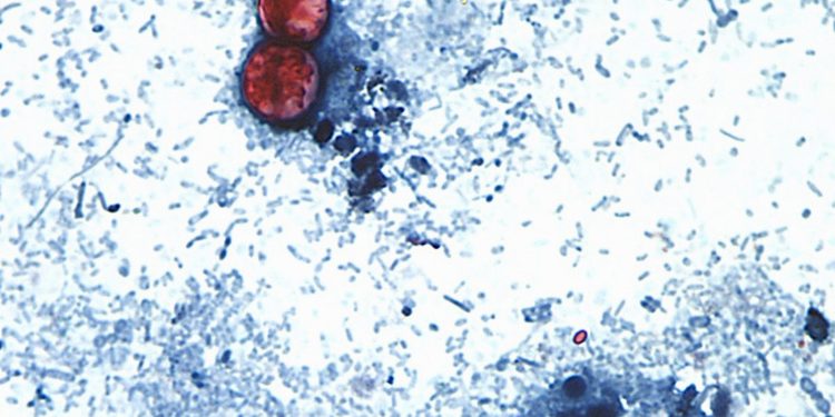 Nuovo focolaio di ciclosporiasi negli Usa: 72 casi